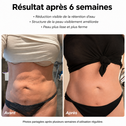 NIMÉA SCULPT™